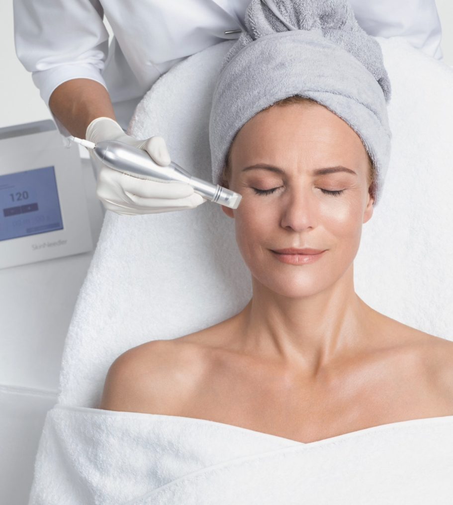 Microneedling