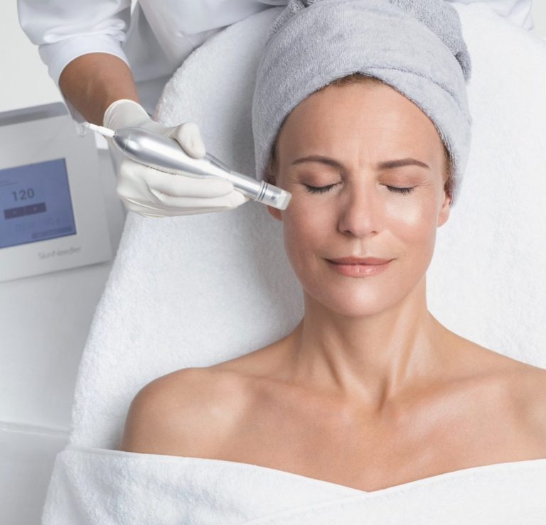 Microneedling Kosmetische behandlung Meran